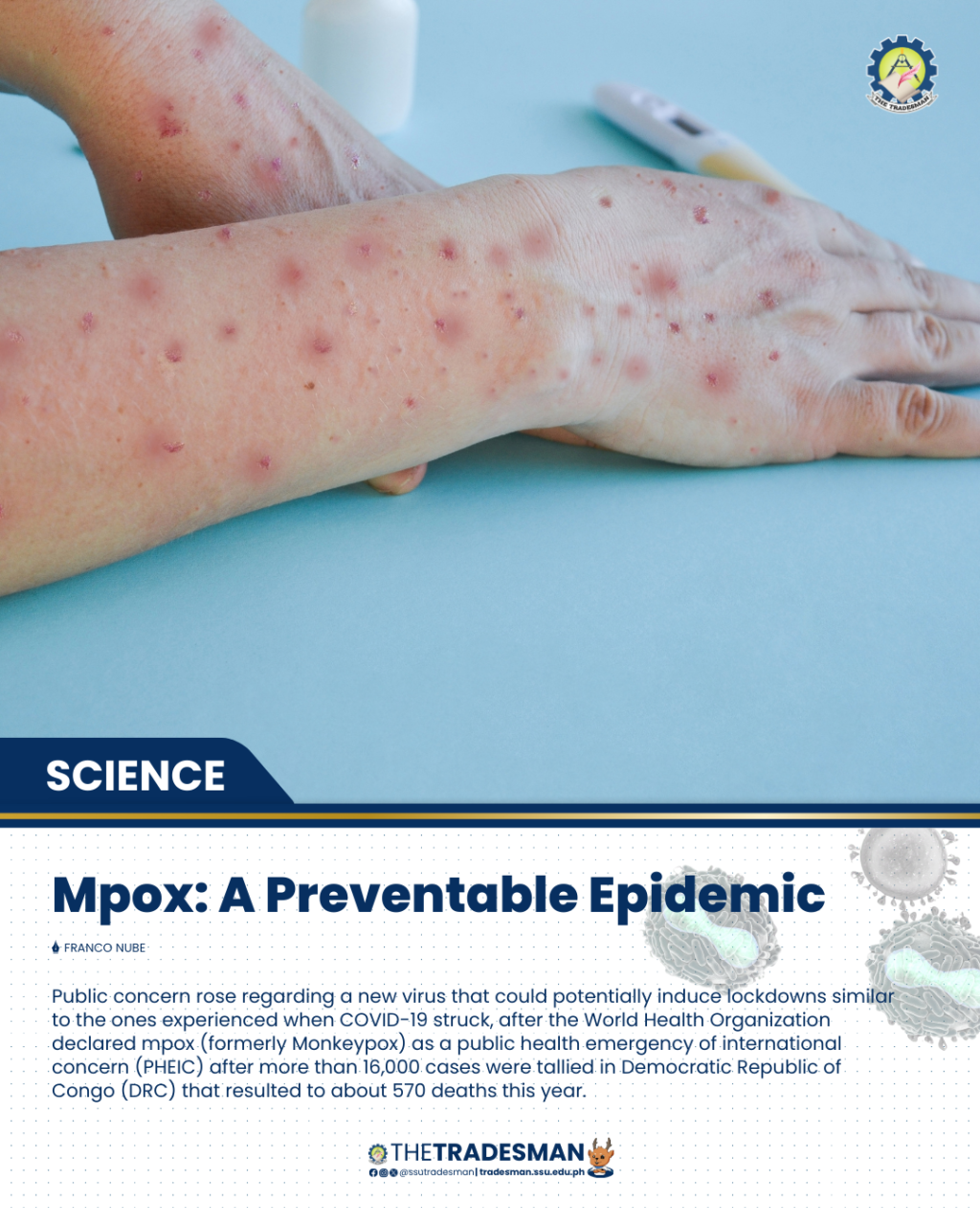 20240825 Mpox A preventable epidemic