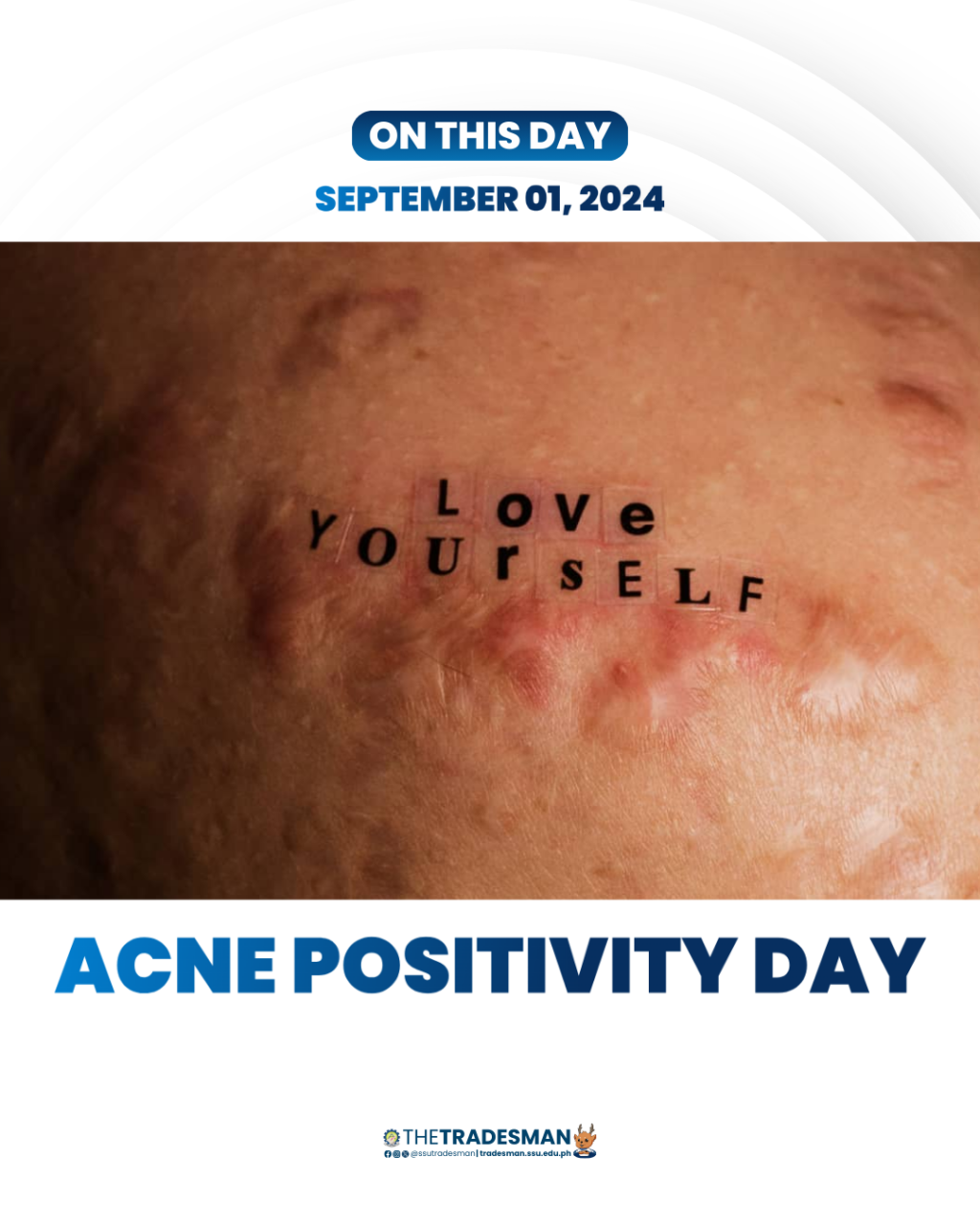 01 Acne Positivity Day